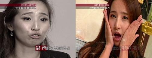 최은 양악수술, 그 씁쓸한 현주소는?